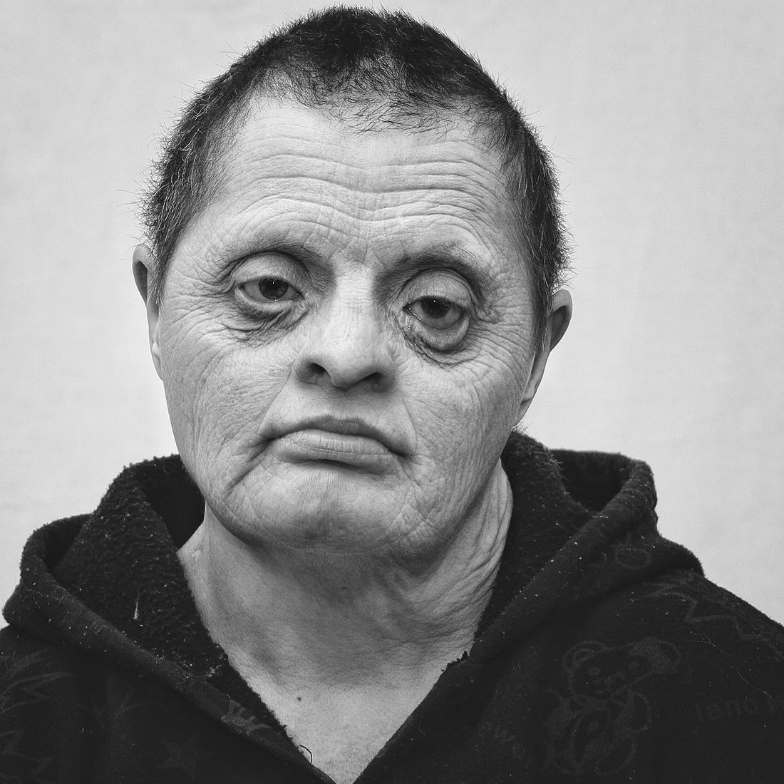 One of the 400 portraits of patients in the PsychoNeurological Internat (PNI), Tinskaya village, Krasnoyarsk region, Siberia, Russia. Photo by Oleg Klimov