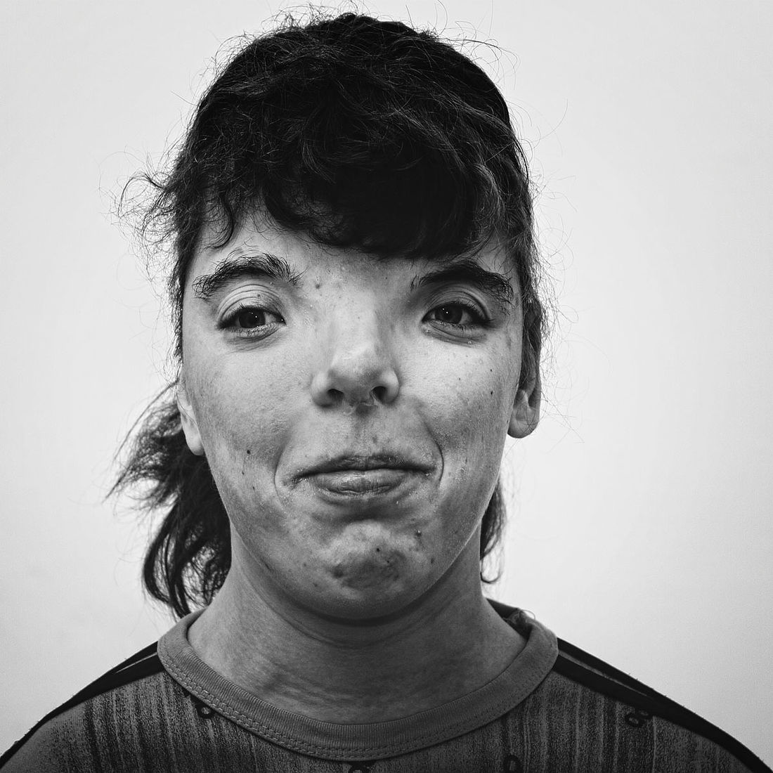 One of the 400 portraits of patients in the PsychoNeurological Internat (PNI), Tinskaya village, Krasnoyarsk region, Siberia, Russia. Photo by Oleg Klimov